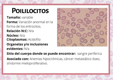 Poililocitos Hematología Eritrocitos Fundamentos