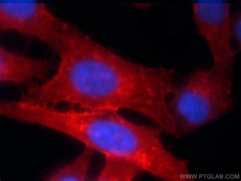 Hla Class I Abc Antibody 15240 1 Ap Proteintech