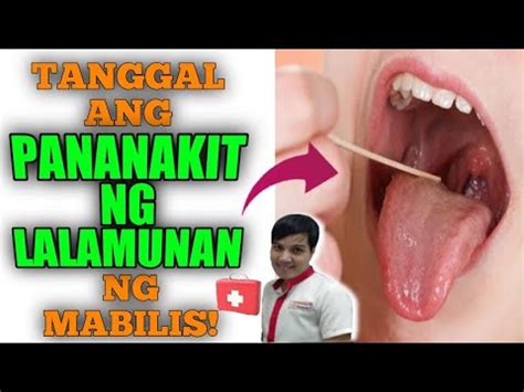 Anong Gamot Sa Sobrang Sakit Ng Lalamunan Medisinagamot