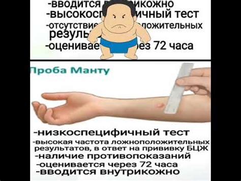 Реакция манту - YouTube