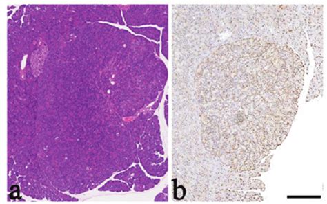 Acinar Cell Hyperplasia Ach In Rats Treated With 50 Mg Kg N ‐methyl