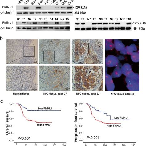 Expression And Amplification Of Fmnl1 In Npc Cell Lines And