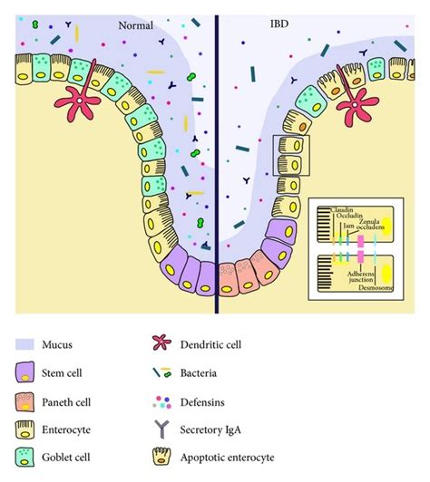 Intestinal Mucosal Disease