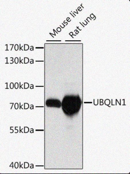 Rabbit anti UBQLN1 Polyclonal Antibody 爱必信 absin 官网