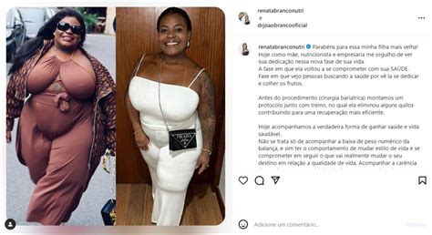 Foto Nutricionista De Jojo Todynho Revelou Que Cantora Perdeu Mais De