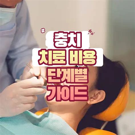 충치 치료 비용 단계별 가이드