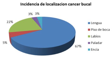 Onconurse C Ncer De Boca