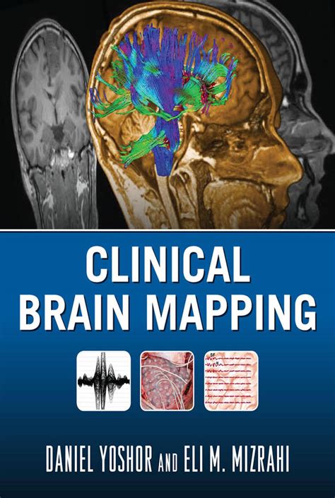 Clinical Brain Mapping Calicut Books