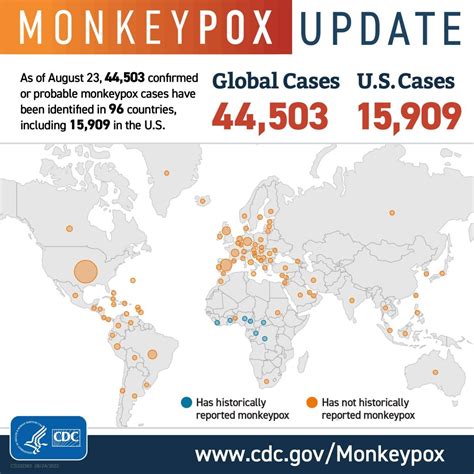 Monkeypox Outbreak Usa Anni Malena