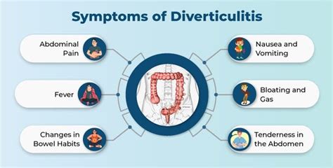 Diverticulitis Causes Symptoms Diagnosis And Treatment