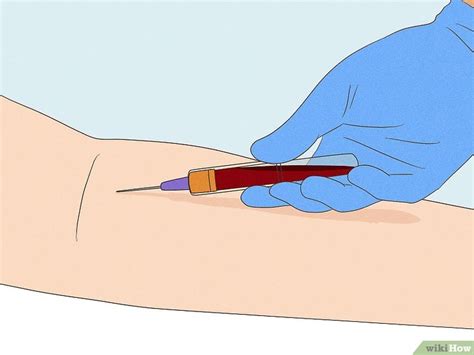 How to Recognize the Symptoms of Appendicitis: 8 Signs 