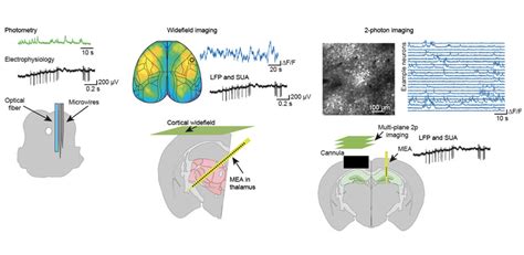 Light and electricity combine to reveal integrated brain functioning