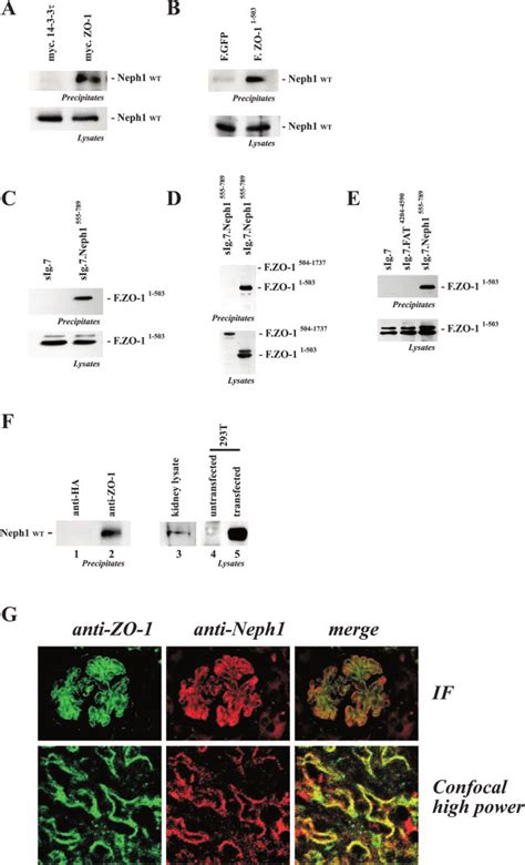 The Cytoplasmic Tail Of Neph1 Interacts With ZO 1 A And B HEK 293T