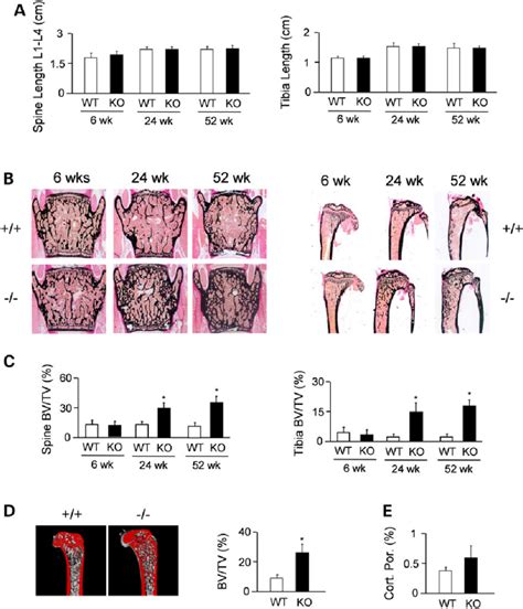 Progressive Increase Of Trabecular Bone Mass In Idua Deficient Mice