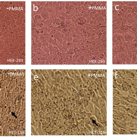 Sem Surface Morphology Of Pmma Particles At Two Magnifications 20000Â Download Scientific