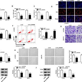 Circ Enhanced Tmz Resistance In Tmz Resistant Gbm Cells A