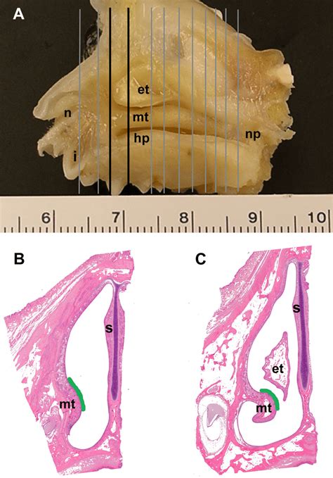 Anatomic Location Of Nasal Tissues Selected For Morphometric Analysis Download Scientific