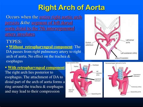 Ppt The Aortic Arches Powerpoint Presentation Free Download Id 5371508