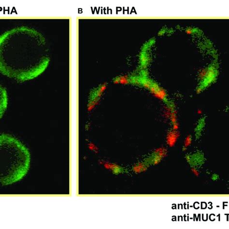 Intracellular Cytoplasmic Tail Of MUC1 Demonstrates Features