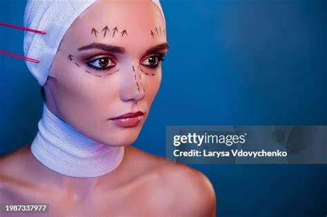 Photo Of Plastic Surgery Patient Girl In Facial Medical Bandage Have