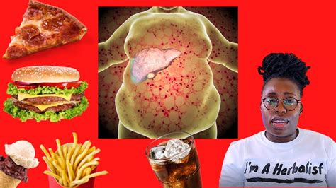 How Fast Food Effects The Body Part 1 How The Food You Eat Affects