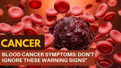 Blood Cancer Symptoms: Don’t Ignore These Warning Signs | by ...