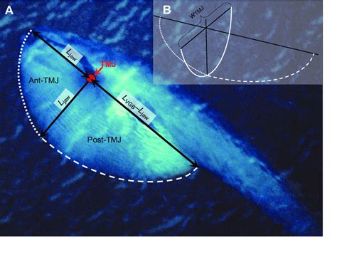 (A). Image of a blue whale lunge feeding near the surface, showing the... | Download Scientific ...