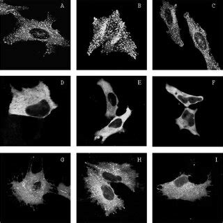 Localization Of Wild Type And Mutant GFP MRme 1 Fusion Proteins In HeLa