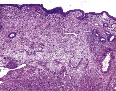 Endometrium Uterus Histology