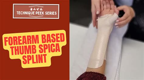 How To Create A Forearm Based Thumb Spica Splint Technique Peek