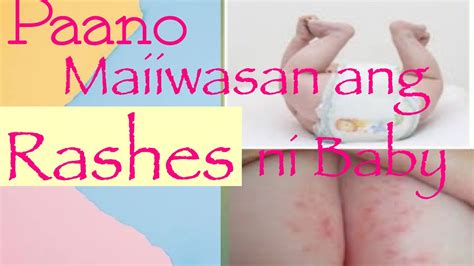 Mabisang Gamot Sa Rashes Sa Pwet