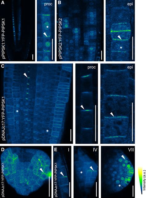 PIP5K1 and PIP5K2 Expression and Subcellular Localization. | Download ... 