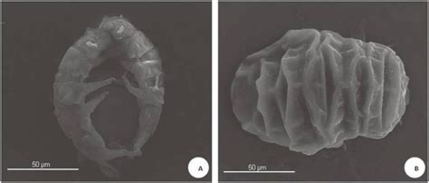 A Fotomicrografia De Dois Espécimes De Stygarctus Bradypus Schulz Download Scientific Diagram