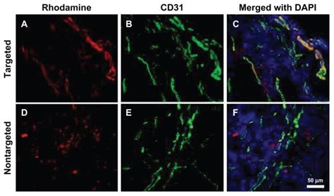 Fluorescence Microscopy Images Of Tumor Tissues Ac Bt Ml