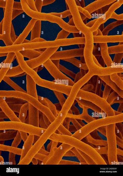 Color An Lisis Micrograf A De Electrones Sem De Streptomyces