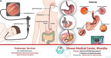 #Endoscopy is a nonsurgical method used to examine a person's digestive ...