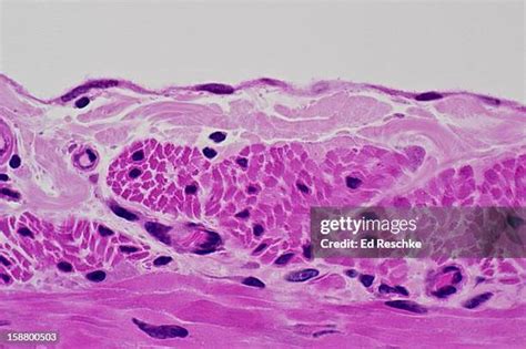 Simple Squamous Epithelium Photos And Premium High Res Pictures Getty