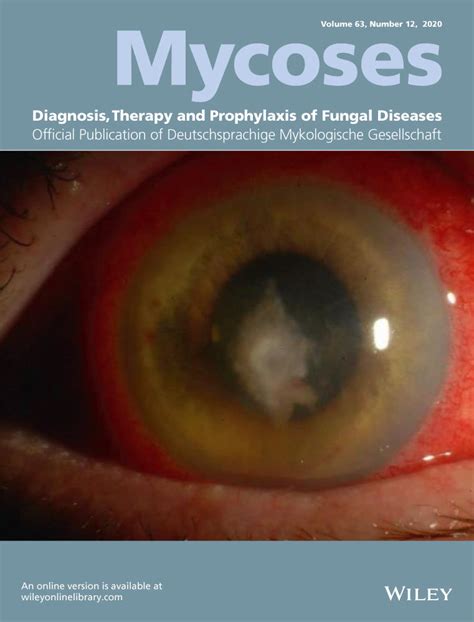 Epidemiology Clinical Features Diagnosis And Treatment Of Cerebral