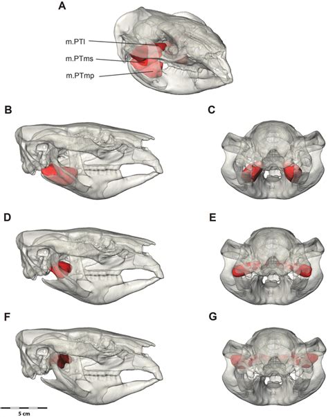 Digital Dissection Of The Pterygoid Muscle Group A Oblique View With