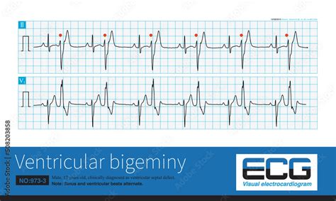 Illustrazione Stock A 17 year old male was clinically diagnosed as ...