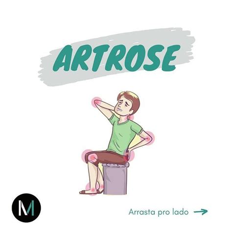 Movimento Otimizado No Instagram A Artrose Atinge Uma Grande Parte Da