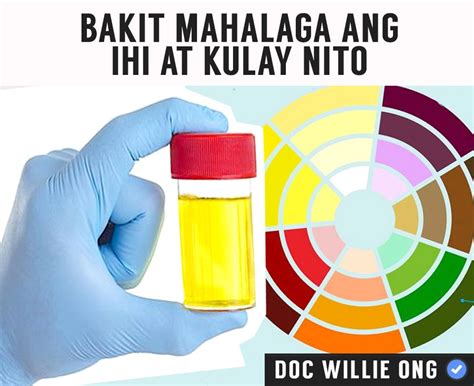 Doc Willie Ong - Bakit Mahalaga ang Ihi at Kulay Nito Payo ni Doc