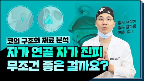 코 성형 재료에 따라 목적도 달라집니다 비중격연골 늑연골 귀연골을 가장 잘 사용하는 방법은 Ft 마인드성형외과