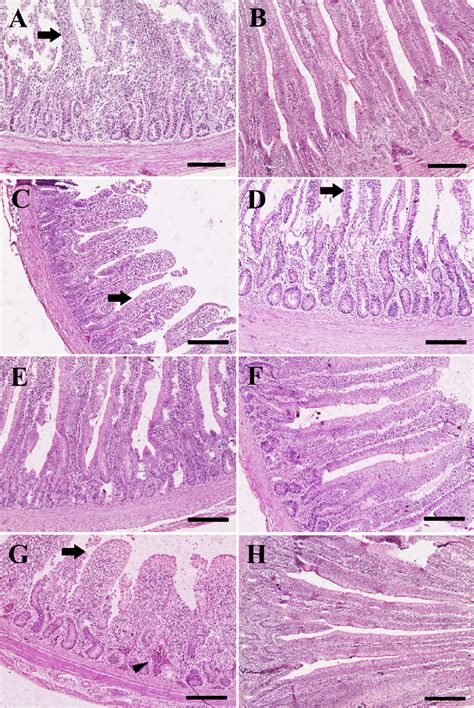 Histopathological Examination Of Chicken S Intestine A Intestine Of