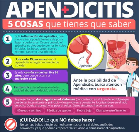 Que Debes Saber Sobre Apendicitis David Nesher Blog