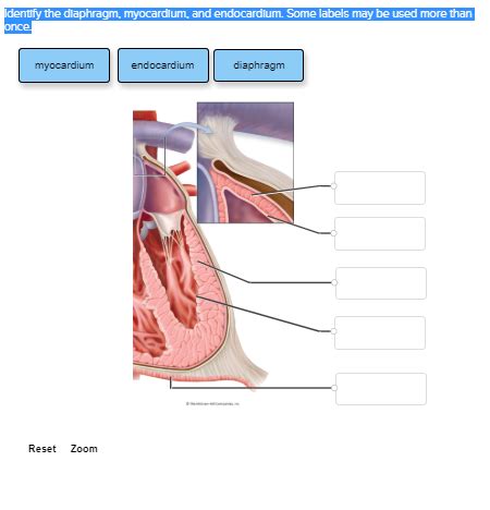 Solved Identify The Diaphragm Myocardium And Endocardium Chegg