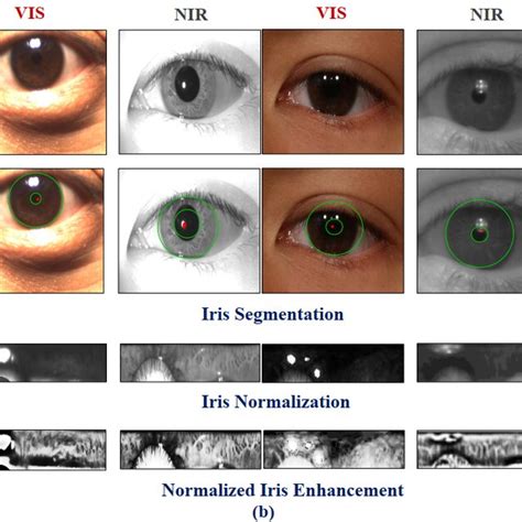 Iris Image Preprocessing Steps Segmentation Normalization