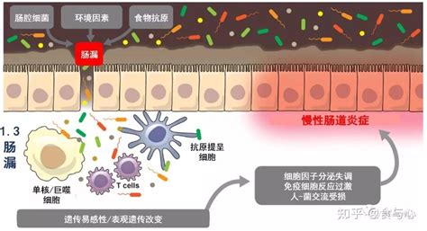 肠漏，你必须知道的热知识13：肠漏的影响、原因和防治总结 知乎