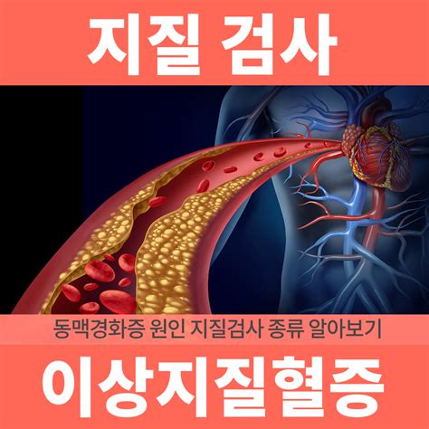 동맥경화의 원인 고지혈증이상 지질혈증의 증상 및 수치 콜레스테롤 수치 A15