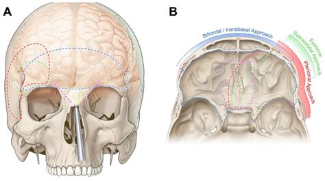 Cancers Free Full Text Surgical Anatomy And Approaches Of The